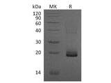 Recombinant Mouse ESM1/Endocan Protein (Human Cells, His Tag)