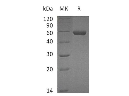 Recombinant Mouse Carboxypeptidase M/CPM Protein (His Tag)