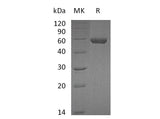 Recombinant Mouse Carboxypeptidase M/CPM Protein (His Tag)