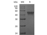 Recombinant Mouse FCRL1 Protein (aa 17-219, His Tag)
