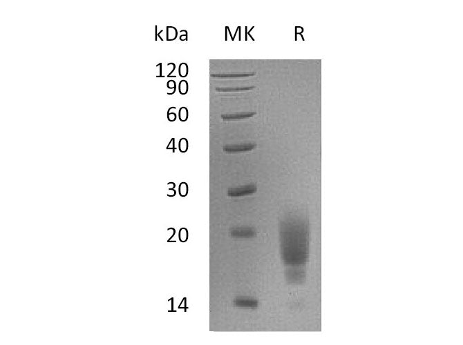 Recombinant Mouse TIGIT Protein (His Tag)