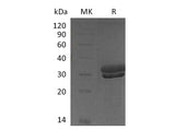 Recombinant Mouse Kallikrein 7/KLK7 Protein (His Tag)