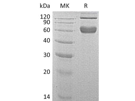 Recombinant Mouse 4-1BB/TNFRSF9 Protein (aa 24-187, Fc Tag)(Active)