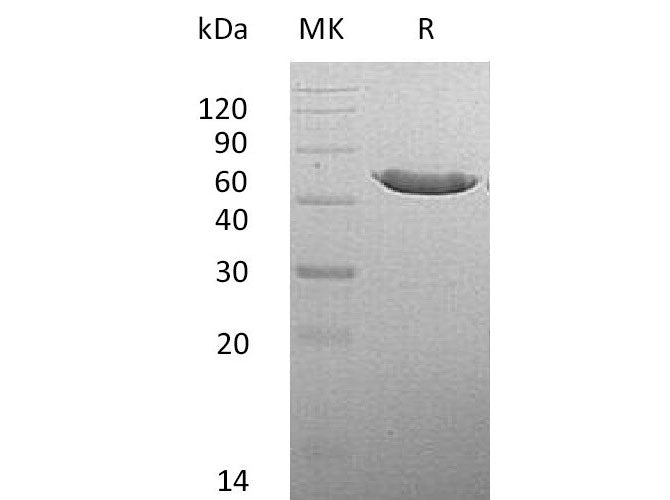 Recombinant Mouse CPA2 Protein (His Tag)