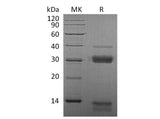 Recombinant Mouse Cathepsin S/CTSS Protein (His Tag)