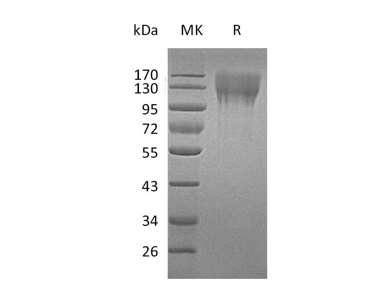 Recombinant Mouse CD96 Protein (His Tag)