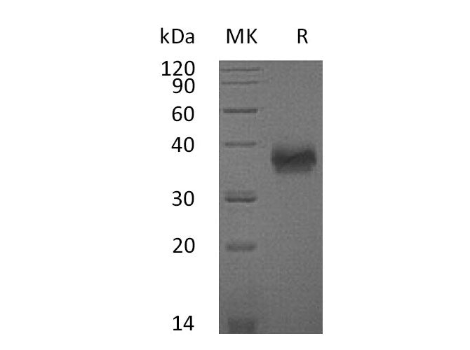 Recombinant Mouse SLAMF5/CD84 Protein (His Tag)