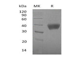 Recombinant Mouse SIGLEC3/CD33 Protein (His Tag)