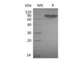 Recombinant Mouse ICAM-2/CD102 Protein (Fc Tag)