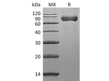 Recombinant Mouse SLAMF3/CD229 Protein (His Tag)