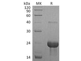 Recombinant Mouse TNFR1/TNFRSF1A Protein
