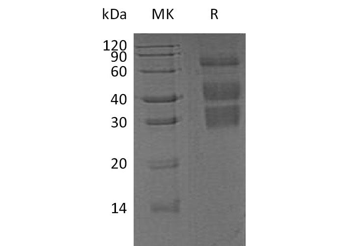 Recombinant Mouse Clusterin/ApoJ Protein (His Tag) Purity >95%