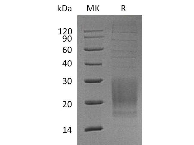 Recombinant Mouse ICOS/AILIM Protein (His Tag)