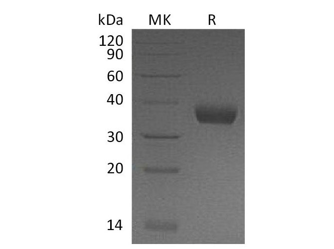 Recombinant Mouse PRLR/Prolactin Receptor Protein (His Tag)