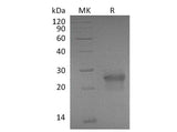 Recombinant Mouse XEDAR/EDA2R Protein (His Tag)