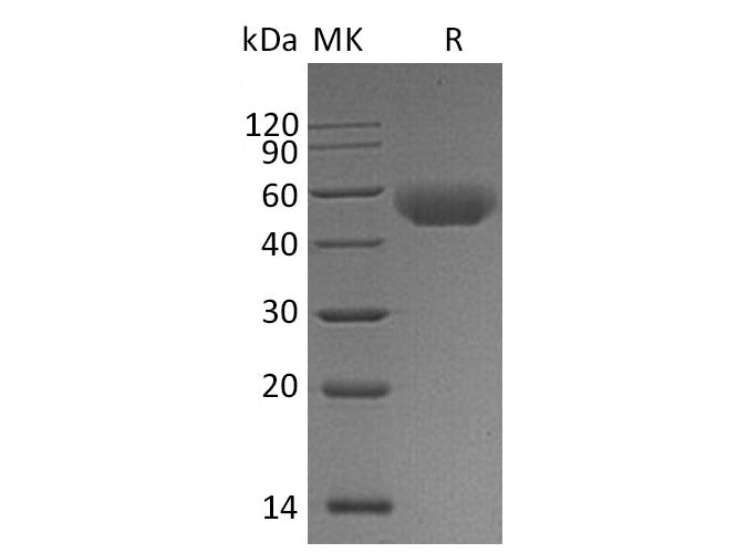 Recombinant Mouse CD5 Protein (aa 24-370, His Tag)