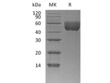 Recombinant Mouse CD147/Basigin Protein (aa 22-325, His Tag)