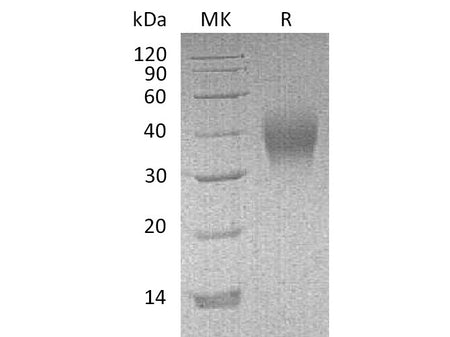 Recombinant Mouse CD16/FCGR3 Protein (His Tag)(Active)