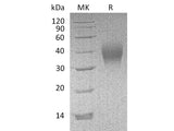 Recombinant Mouse CD16/FCGR3 Protein (His Tag)(Active)