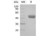 Recombinant Mouse CD112/Nectin-2 Protein (His Tag)(Active) Purity >95%