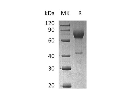 Recombinant Mouse IL2Ra/CD25 Protein (Fc Tag)