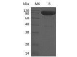 Recombinant Mouse DR6/TNFRSF21 Protein (His Tag)