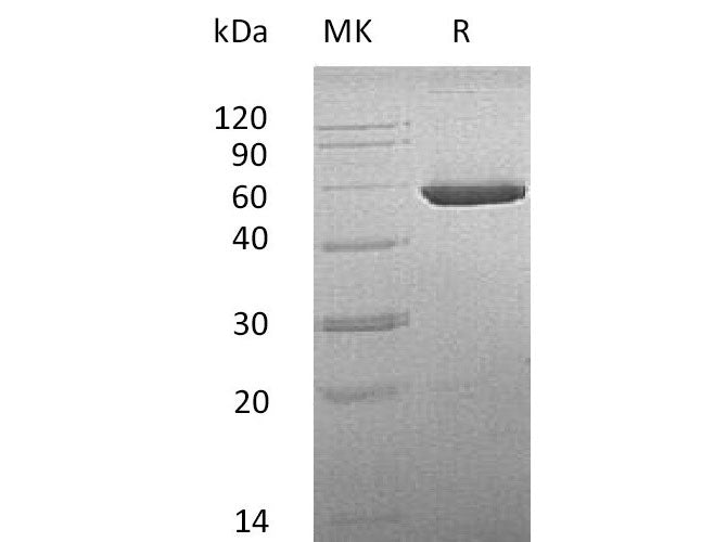 Recombinant Mouse CNDP2/CPGL/PEPA Protein (His Tag)