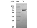 Recombinant Mouse CNDP2/CPGL/PEPA Protein (His Tag)