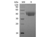 Recombinant Mouse CD226/DNAM-1 Protein (His Tag)