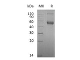 Recombinant Mouse ALK-1/ACVRL1 Protein (Fc Tag)