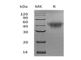 Recombinant Mouse TNFRSF1B/CD120b Protein (His Tag) 