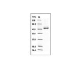 Recombinant Mouse Cathepsin D/CTSD Protein (His Tag)