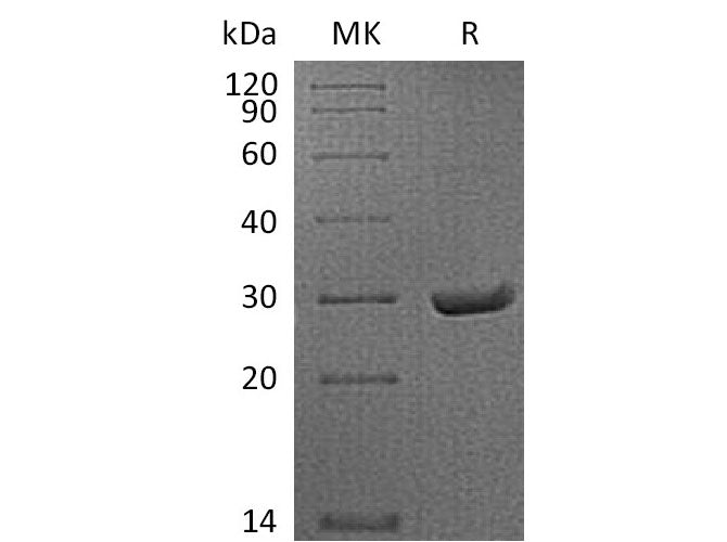 Recombinant Mouse APCS/SAP Protein (His Tag)