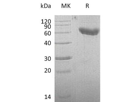 Recombinant Mouse CD28/TP44 Protein (Fc & His Tag)