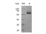 Recombinant Mouse IL7RA/CD127 Protein (Fc Tag)(Active)