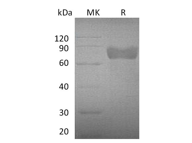 Recombinant Mouse Growth Hormone Receptor/GHR Protein (Fc Tag)