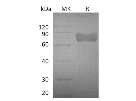 Recombinant Mouse Growth Hormone Receptor/GHR Protein (Fc Tag)