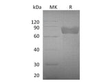 Recombinant Mouse Growth Hormone Receptor/GHR Protein (Fc Tag)