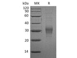 Recombinant Mouse CD16-2/FCGR4 Protein (His Tag)(Active) Purity >95%