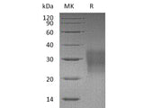Recombinant Mouse FAS/TNFRSF6 Protein (His Tag)