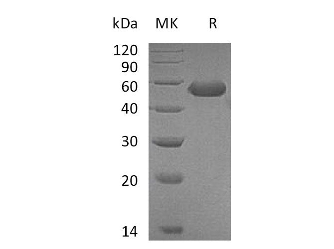 Recombinant Mouse CD5L Protein (His Tag) Purity >95%