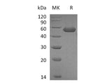 Recombinant Mouse CD5L Protein (His Tag) Purity >95%