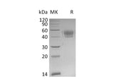 Recombinant Mouse PD-L1/B7-H1/CD274 Protein (His Tag)
