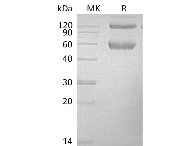 Recombinant Mouse BMPRIA/ALK-3 Protein (Fc & His Tag)