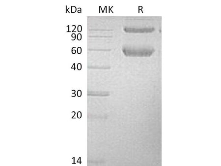 Recombinant Mouse BMPRIA/ALK-3 Protein (Fc & His Tag)