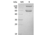 Recombinant Mouse BMPRIA/ALK-3 Protein (Fc & His Tag)