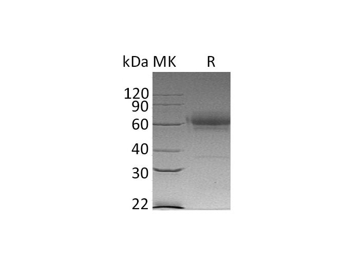 Recombinant Mouse CD27/TNFRSF7 Protein (Fc & His Tag)