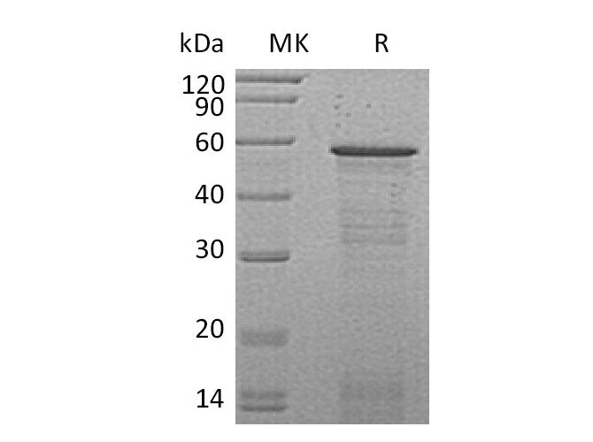 Recombinant Mouse Host Cell Factor 2/HCFC2 Protein (His Tag)