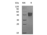 Recombinant Mouse TROP2/TACSTD2 Protein (His Tag)