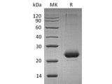 Recombinant Mouse CD40/TNFRSF5 Protein (His Tag)(Active)